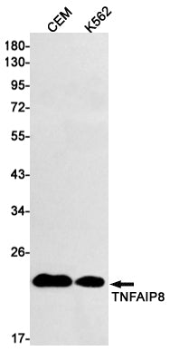 TNFAIP8 Rabbit Monoclonal Antibody