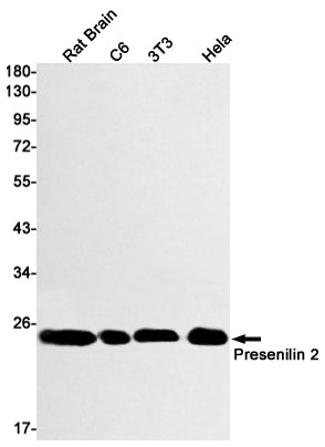 Presenilin 2 Rabbit Monoclonal Antibody