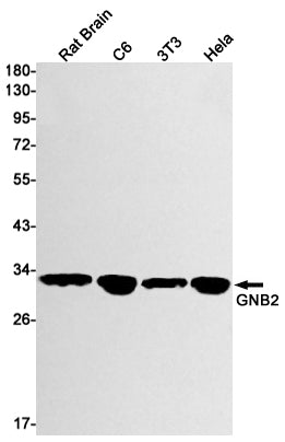 GNB2 Rabbit Monoclonal Antibody