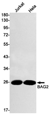 BAG2 Rabbit Monoclonal Antibody