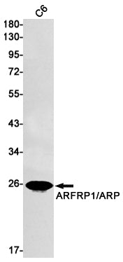 ARFRP1 Rabbit Monoclonal Antibody