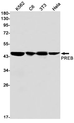 PREB Rabbit Monoclonal Antibody