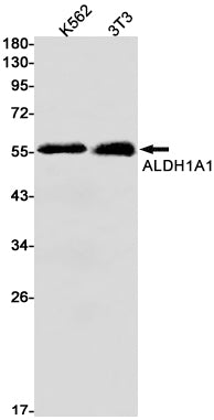 ALDH1A1 Rabbit Monoclonal Antibody