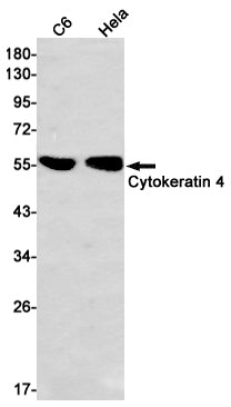 Cytokeratin 4 Rabbit Monoclonal Antibody