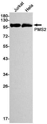 PMS2 Rabbit Monoclonal Antibody