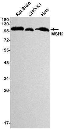 MSH2 Rabbit Monoclonal Antibody