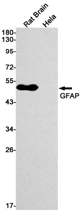 GFAP Rabbit Monoclonal Antibody