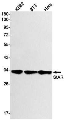 StAR Rabbit Monoclonal Antibody