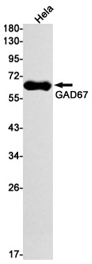 GAD67 Rabbit Monoclonal Antibody