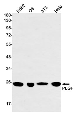 PLGF Rabbit Monoclonal Antibody