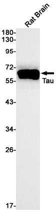 Tau Rabbit Monoclonal Antibody