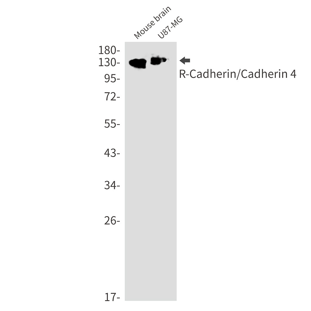 R Cadherin Rabbit Monoclonal Antibody