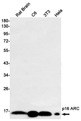 p16 ARC Rabbit Monoclonal Antibody