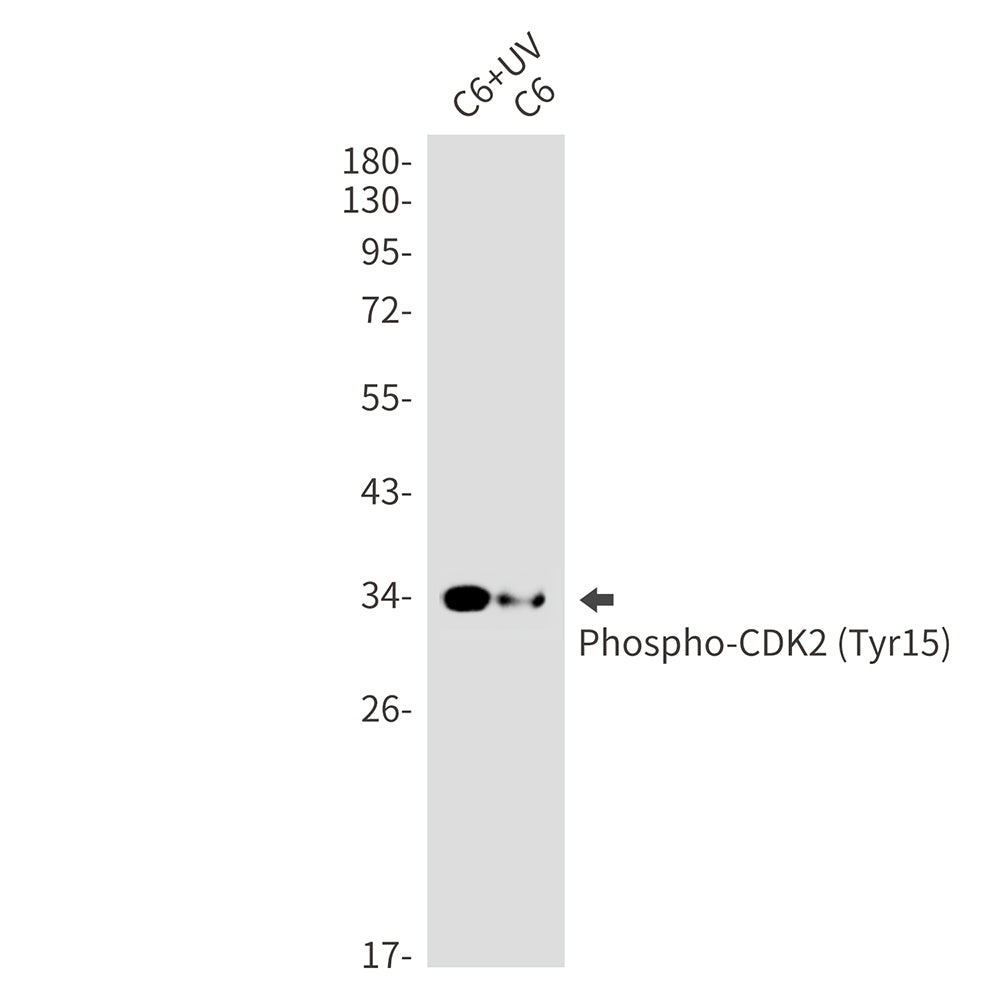 Phospho-CDK2 (Tyr15) Rabbit Monoclonal Antibody