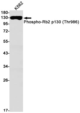 Phospho-Rb2 p130 (Thr986) Rabbit Monoclonal Antibody