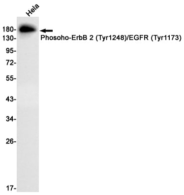 Phosoho-ErbB 2/EGFR (Tyr1248/Tyr1173) Rabbit Monoclonal Antibody