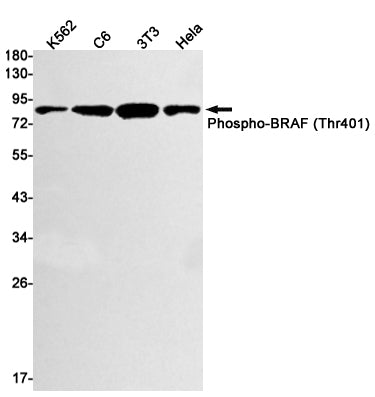 Phospho-BRAF (Thr401) Rabbit Monoclonal Antibody