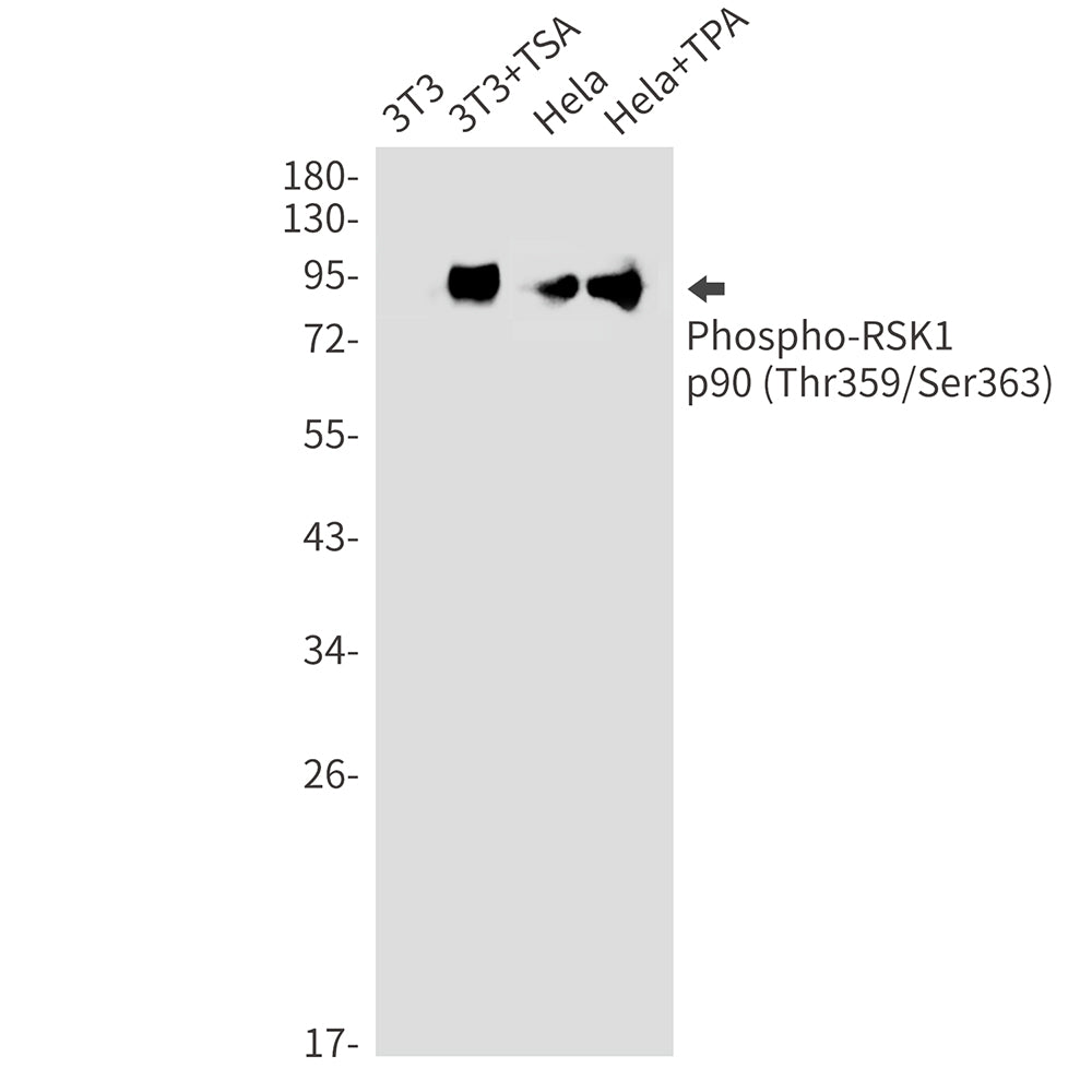 Phospho-RSK1 p90 (Thr359/Ser363) Rabbit Monoclonal Antibody