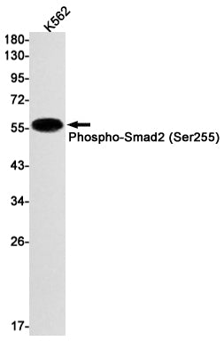 Phospho-Smad2 (Ser255) Rabbit Monoclonal Antibody