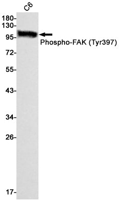 Phospho-FAK (Tyr397) Rabbit Monoclonal Antibody
