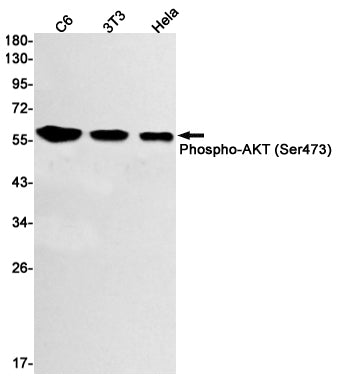 Phospho-AKT (Ser473) Rabbit Monoclonal Antibody