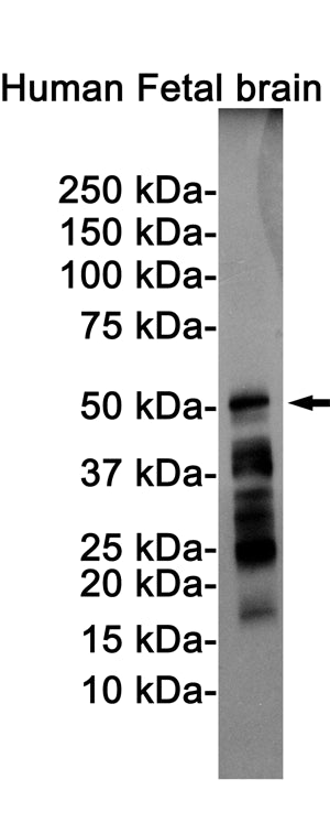 Phospho-Tau (Ser198) Rabbit Monoclonal Antibody