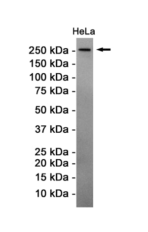 ATM Rabbit Monoclonal Antibody