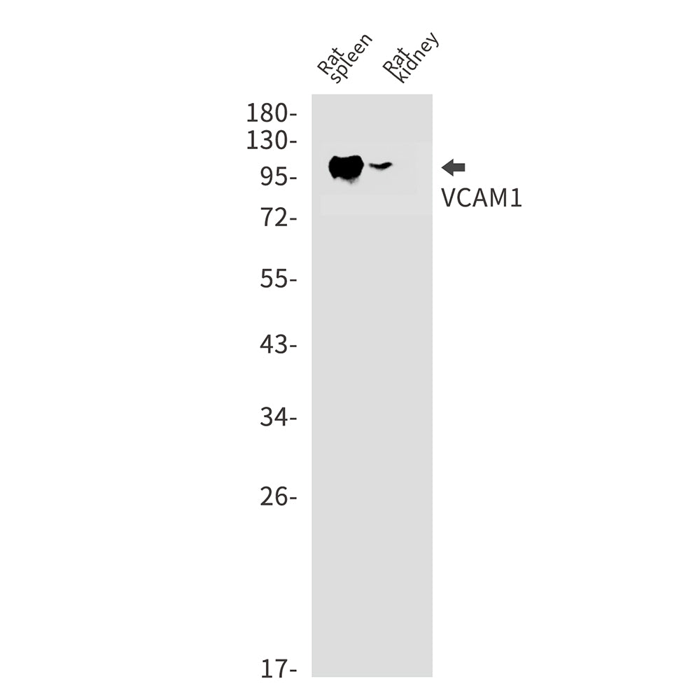 VCAM1 Rabbit Monoclonal Antibody