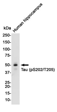 Phospho-Tau (Ser202/Thr205) Rabbit Monoclonal Antibody