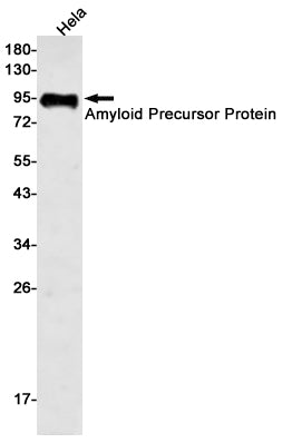 Amyloid Precursor Protein Rabbit Monoclonal Antibody