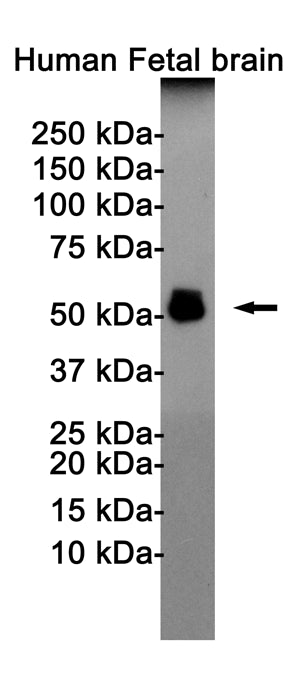 Phospho-Tau (Thr181) Rabbit Monoclonal Antibody