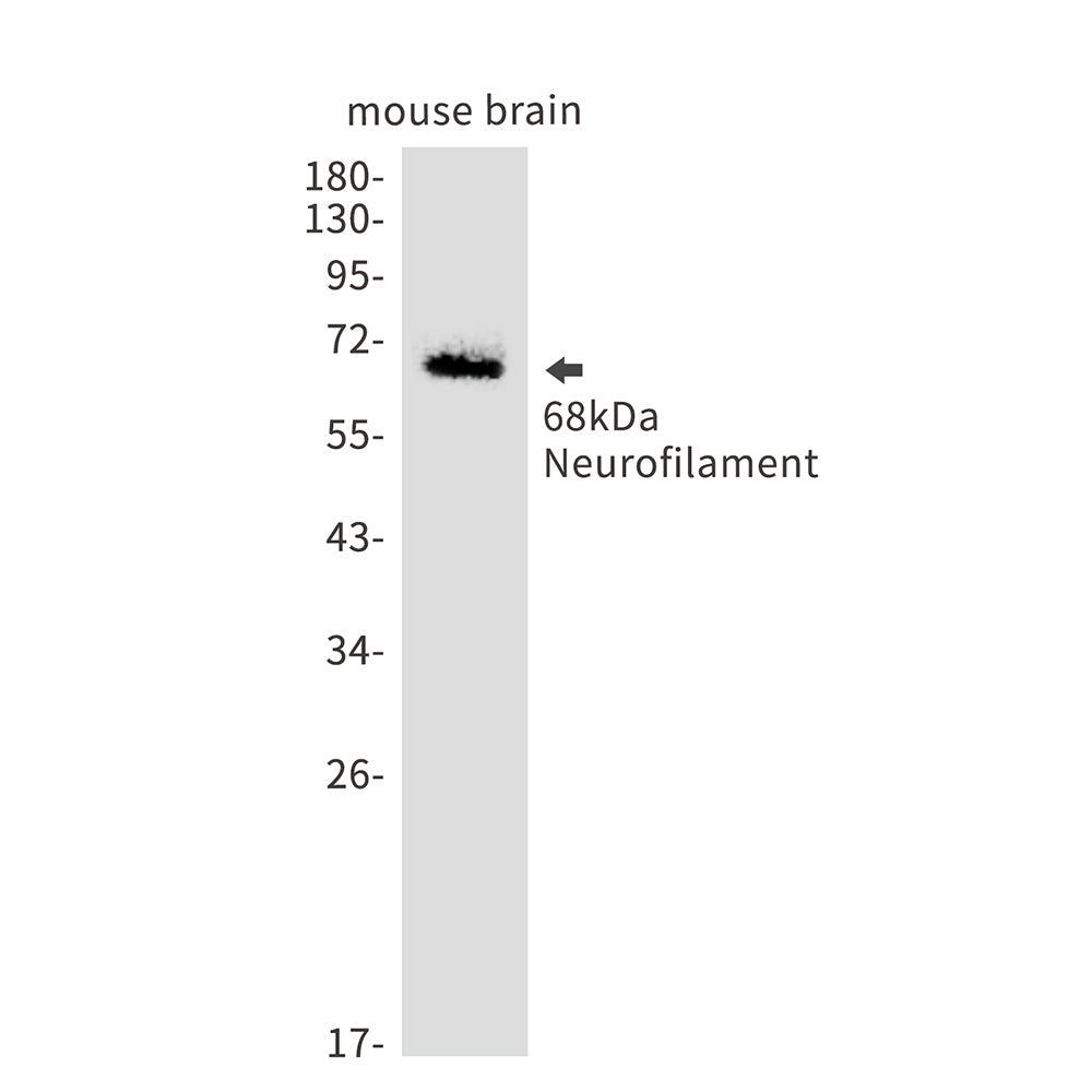 Neurofilament light polypeptide Rabbit Monoclonal Antibody