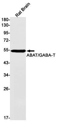 ABAT Rabbit Monoclonal Antibody