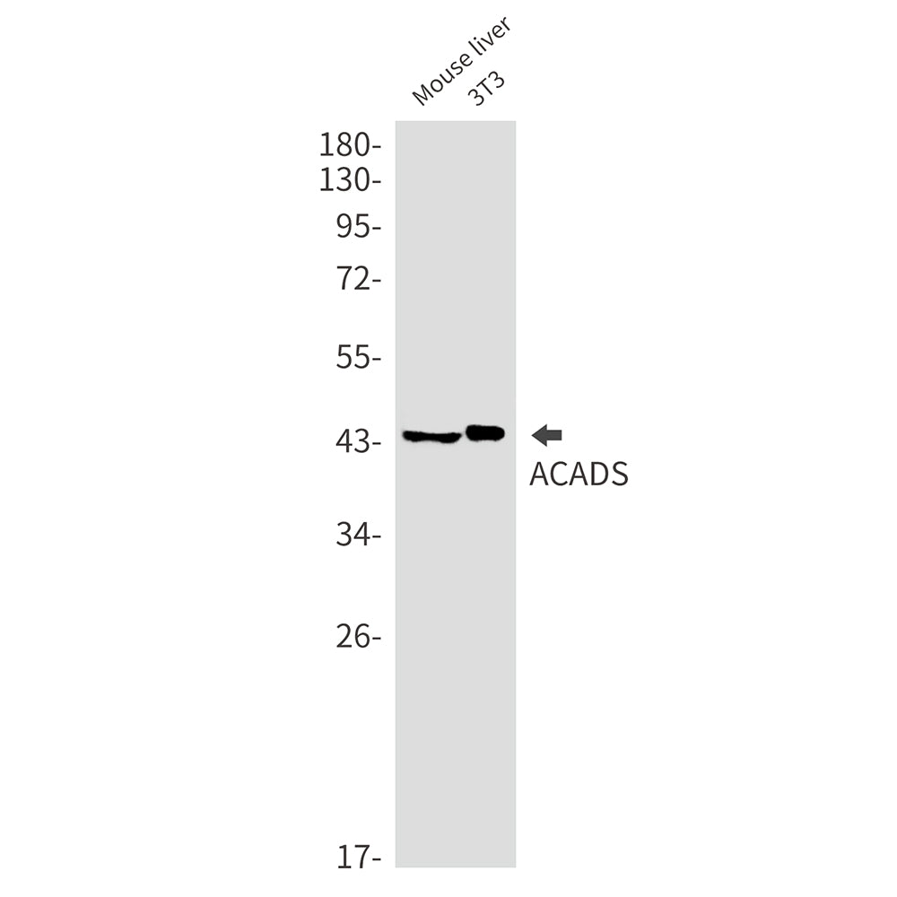 ACADS Rabbit Monoclonal Antibody