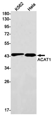 ACAT1 Rabbit Monoclonal Antibody