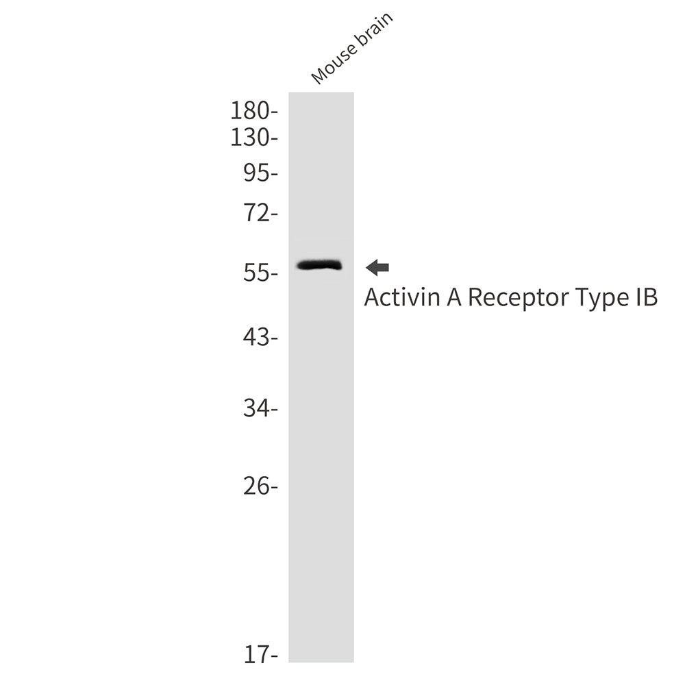 Activin A Receptor Type IB Rabbit Monoclonal Antibody