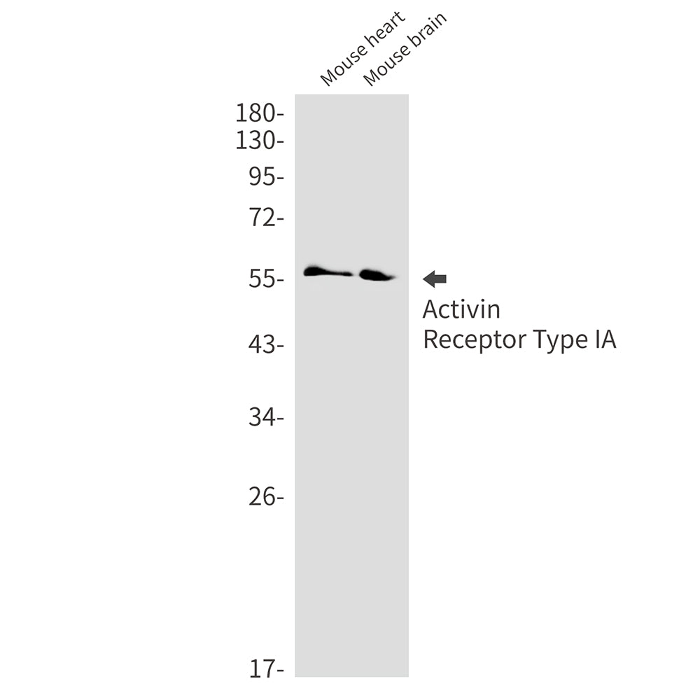 Activin Receptor Type IA Rabbit Monoclonal Antibody