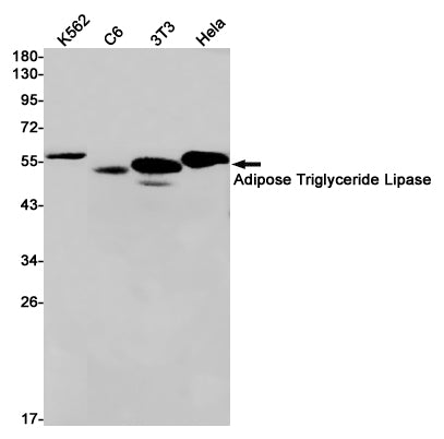 Adipose Triglyceride Lipase Rabbit Monoclonal Antibody