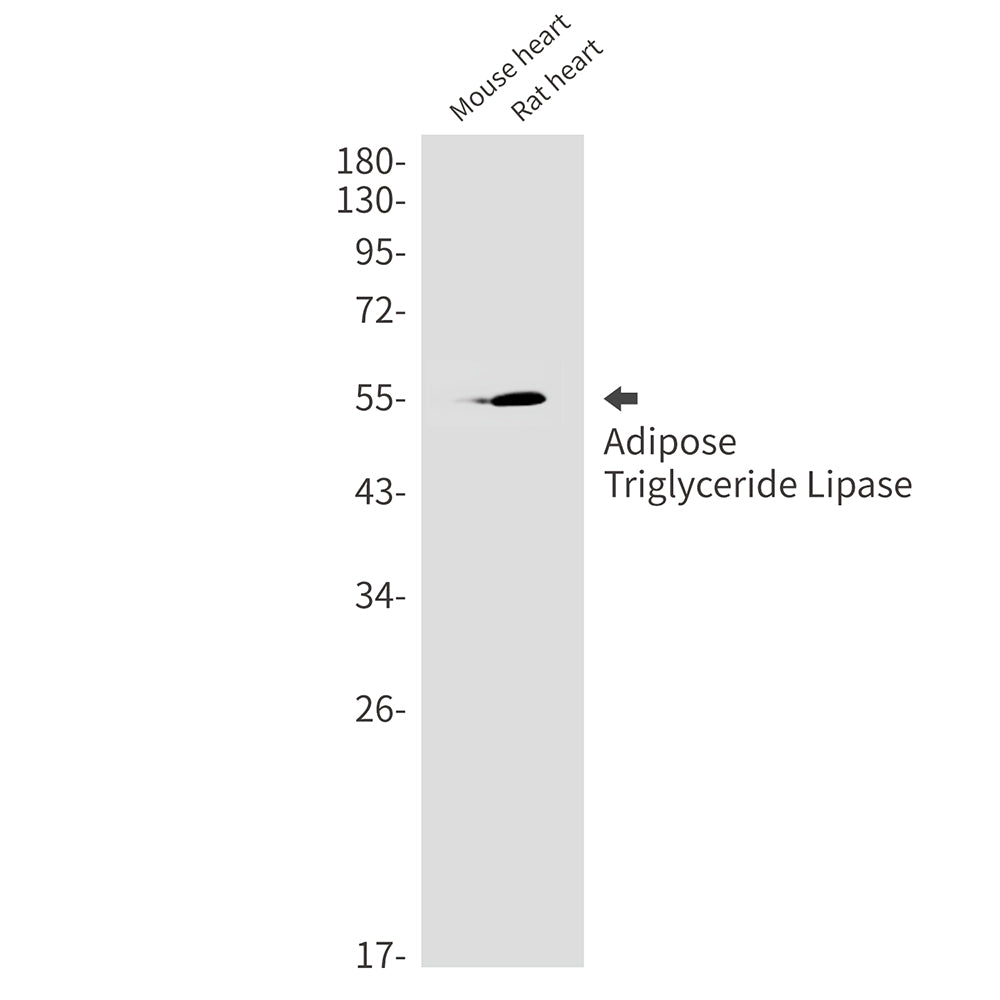 Adipose Triglyceride Lipase Rabbit Monoclonal Antibody