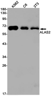 ALAS2 Rabbit Monoclonal Antibody