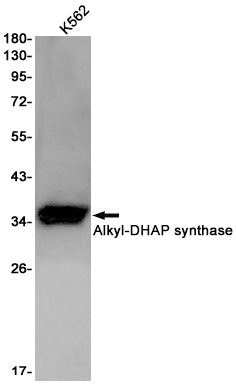 AGPS Rabbit Monoclonal Antibody