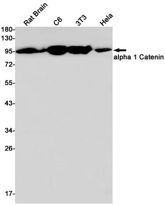 CTNNA1 Rabbit Monoclonal Antibody