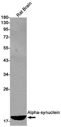 alpha Synuclein Rabbit Monoclonal Antibody