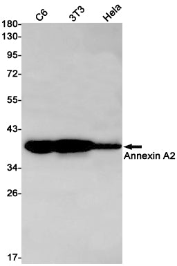 Annexin A2 Rabbit Monoclonal Antibody