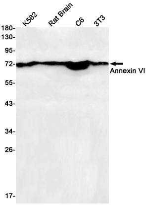 Annexin VI Rabbit Monoclonal Antibody