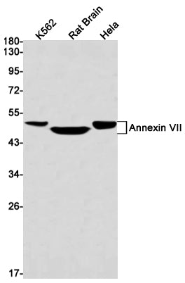 Annexin VII Rabbit Monoclonal Antibody