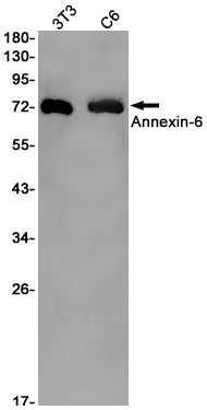 Annexin VI Rabbit Monoclonal Antibody