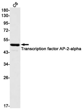 AP2 alpha Rabbit Monoclonal Antibody