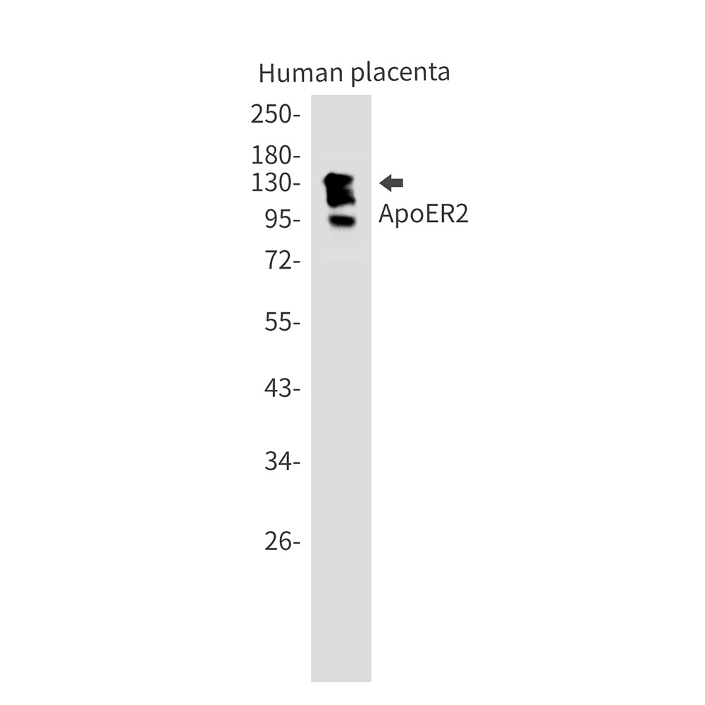 ApoER2 Rabbit Monoclonal Antibody