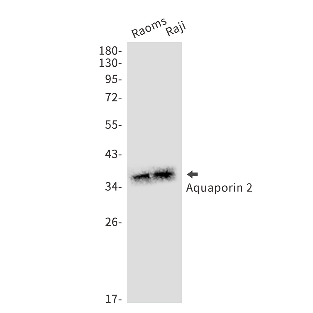 Aquaporin 2 Rabbit Monoclonal Antibody